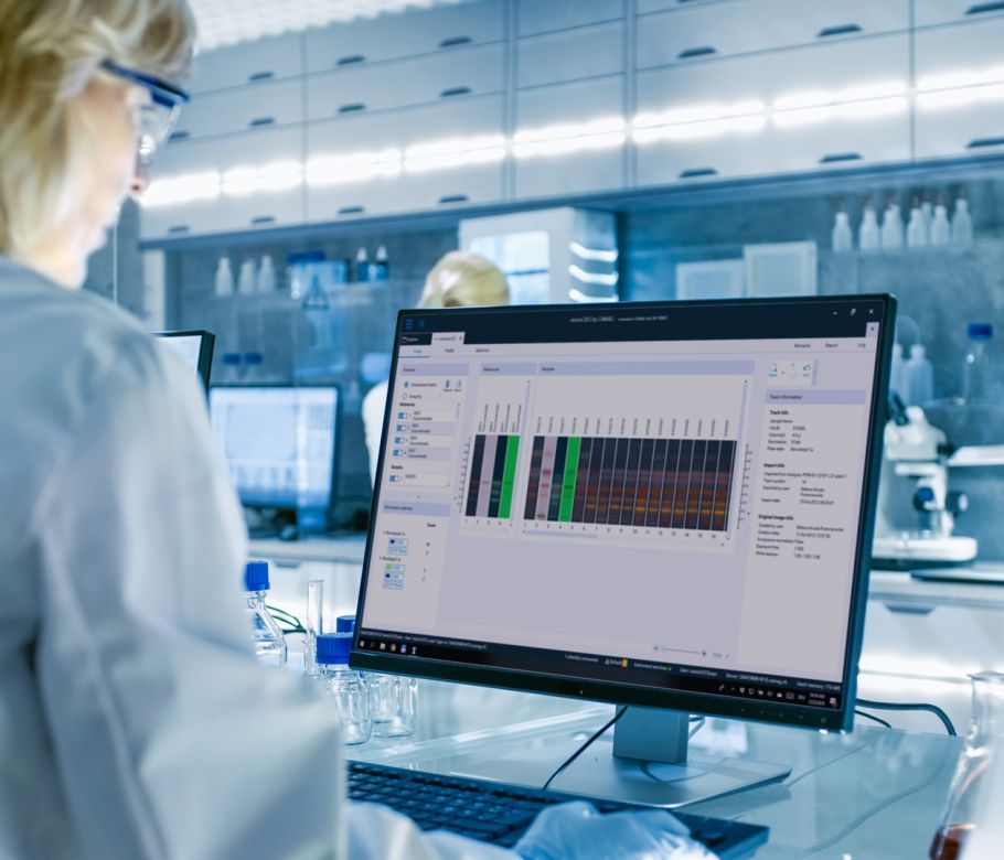 HPTLC Analysis of multiple samples