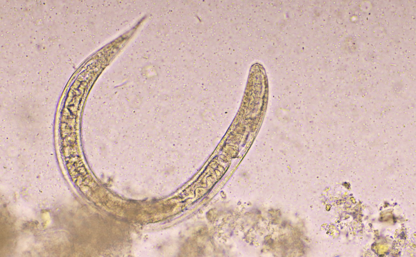 Fully Automated Analysis of Antiparasitic Drugs in Dried Blood Spots