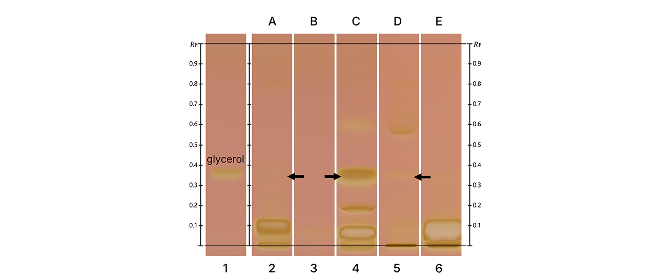 HPTLC fingerprints of tested five different vodka samples (A-E) in white light after derivatization using the glycerol method. 