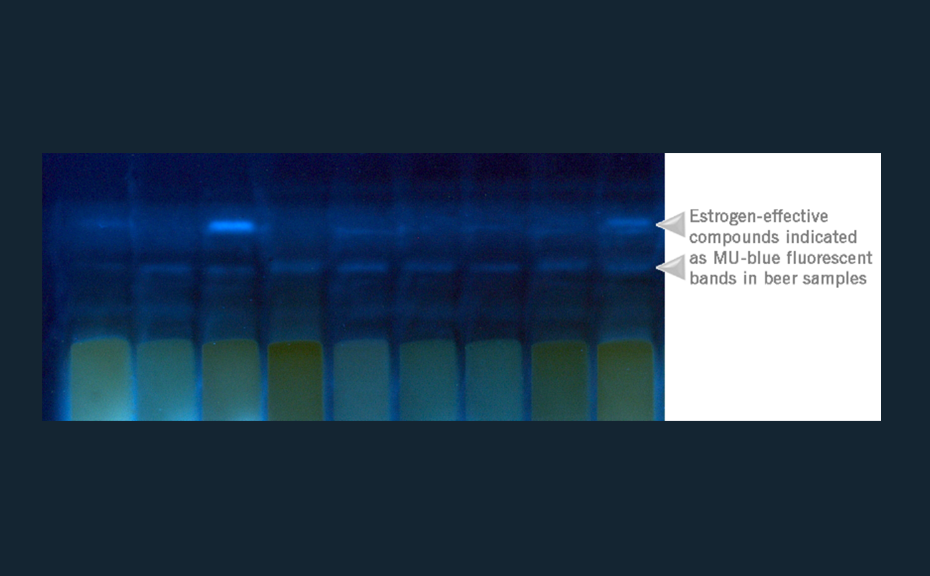 Image of estrogen active compounds in the different beer samples under UV 366 nm